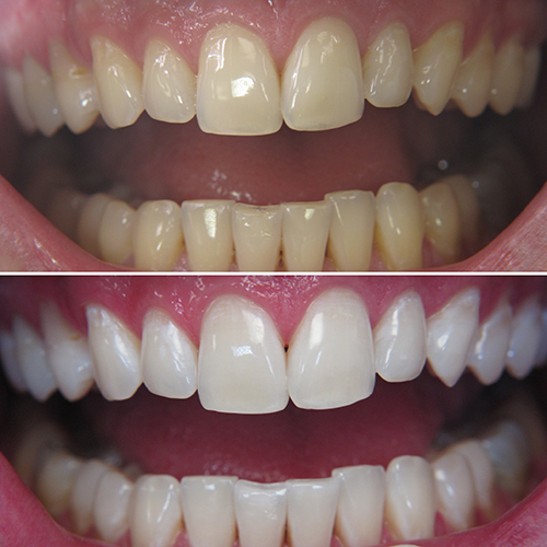 Bleaching Rheda-Wiedenbrück